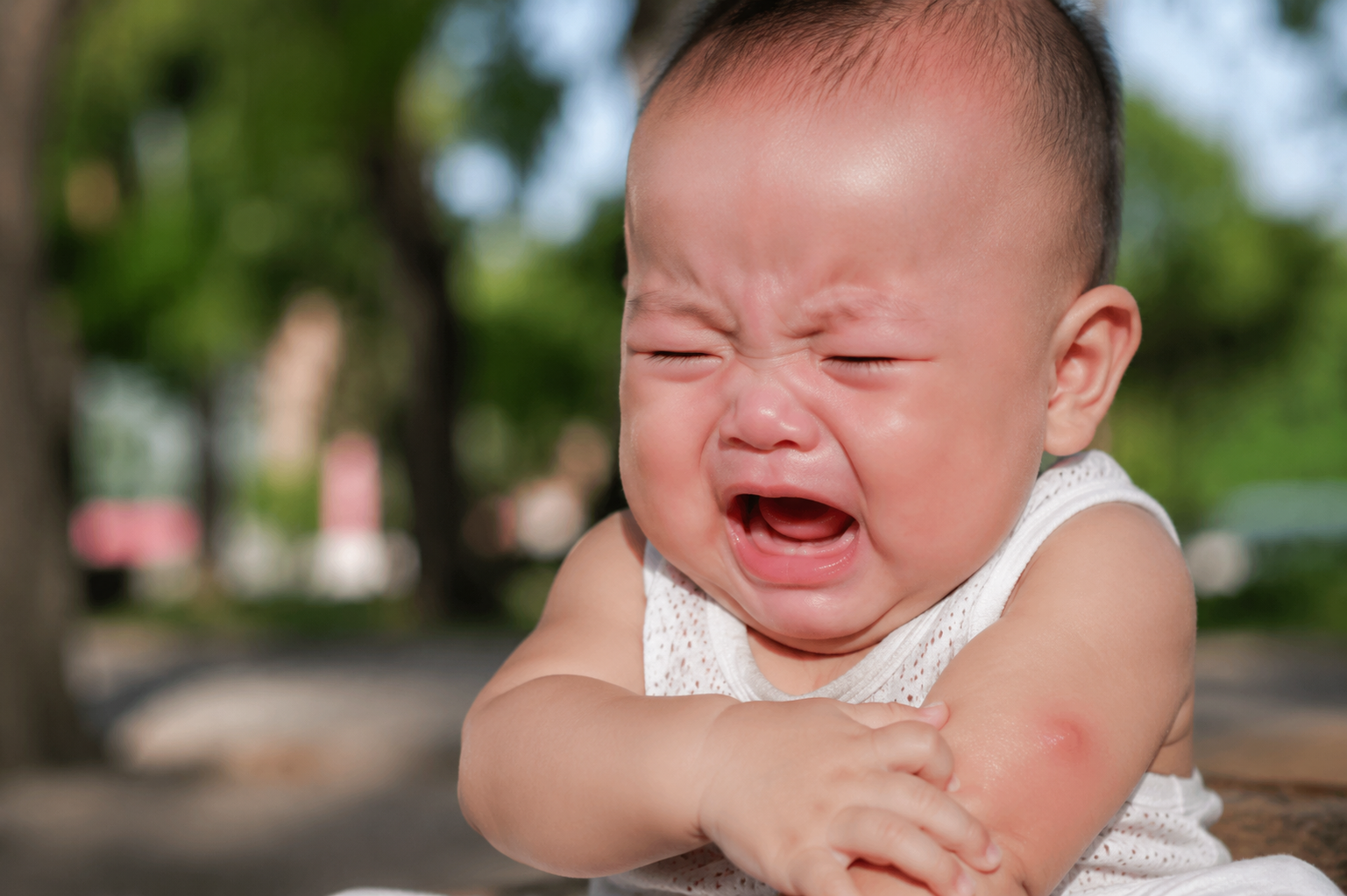 A close-up realistic photography of a 6-month-old Chinese baby crying outdoors in summer, wearing light summer clothes, a visible red mosquito bite on the arm. Natural sunlight, soft background blur, high resolution, 8k, photorealistic, emotive, shot on 85mm lens --ar 3:4 --style raw --v 6.0