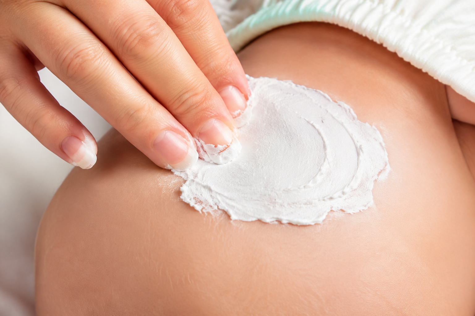 Macro photography of a Chinese mother's hand applying a very thick layer of white zinc oxide cream (looking like white wall spackle or thick frosting) onto smooth baby skin. Bright, clean, clinical yet warm lighting. High detail, commercial skincare product photography style, 8k, photorealistic, safe for work.