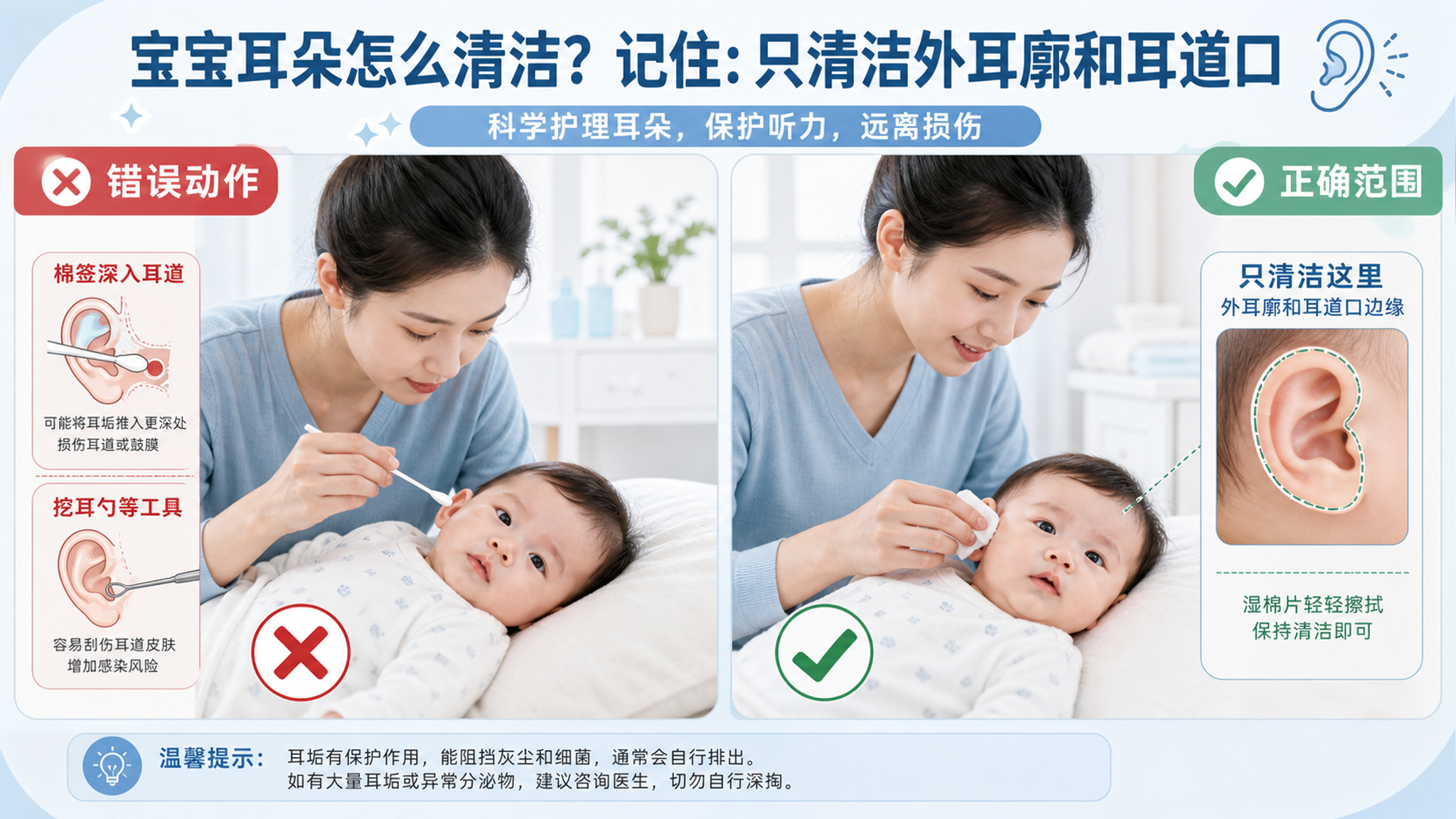 0-1岁宝宝耳垢到底要不要掏？记住这3条安全边界