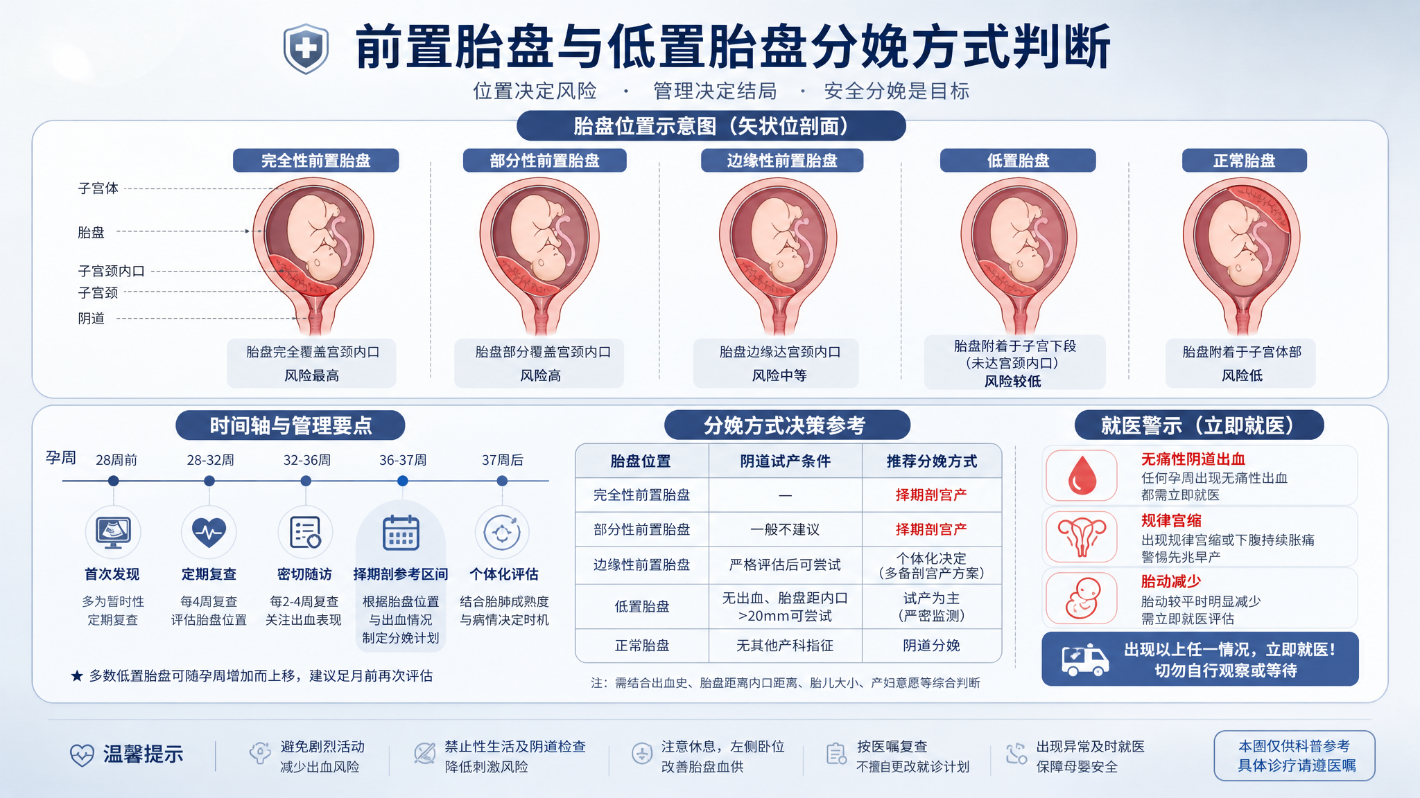冷静蓝灰色医学科普风信息图,画面主体为“前置胎盘与低置胎盘分娩方式判断”示意卡;上半部分是子宫与宫颈
