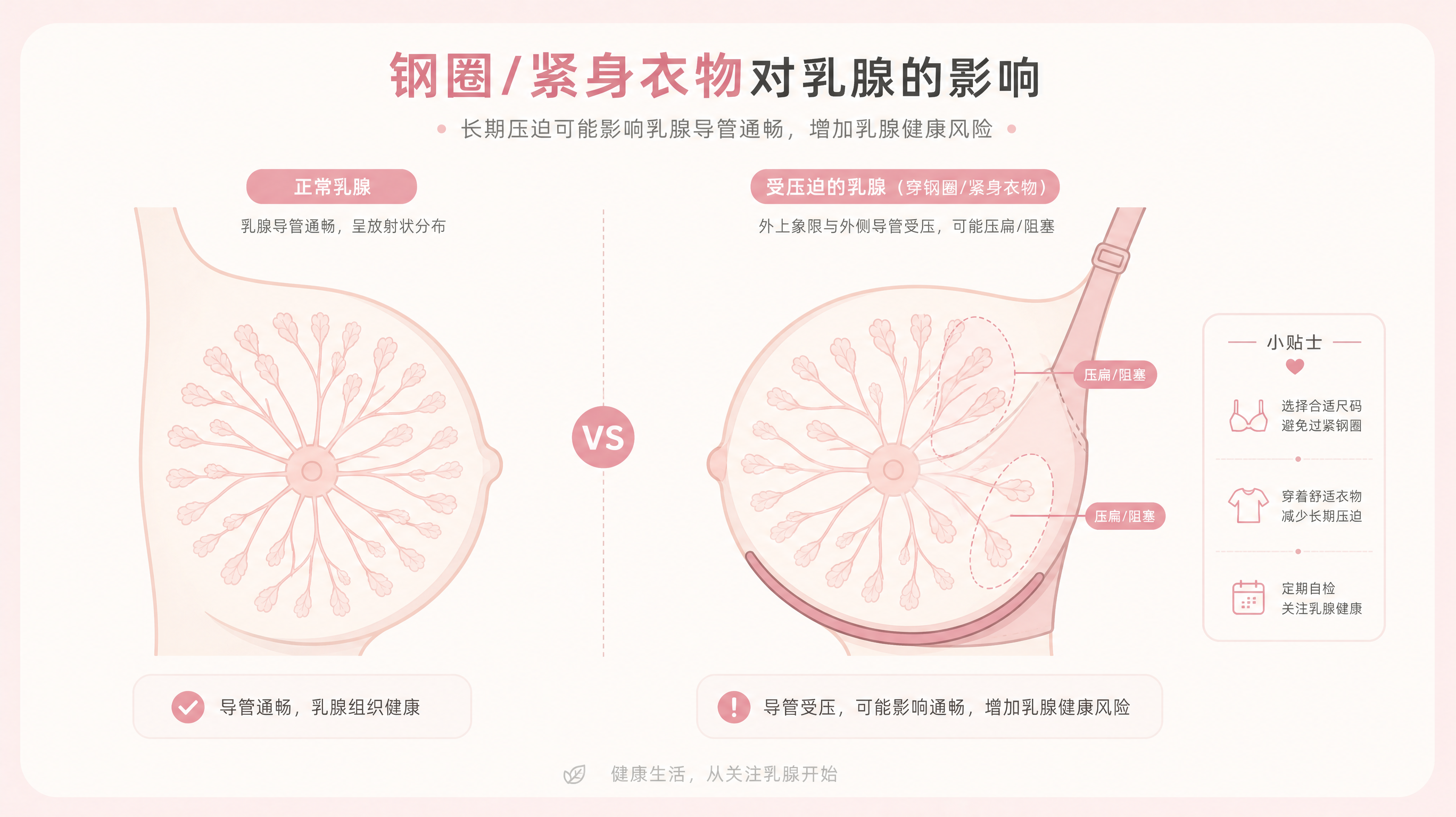 换季胸外侧一胀就疼？先查钢圈压没压到乳腺管