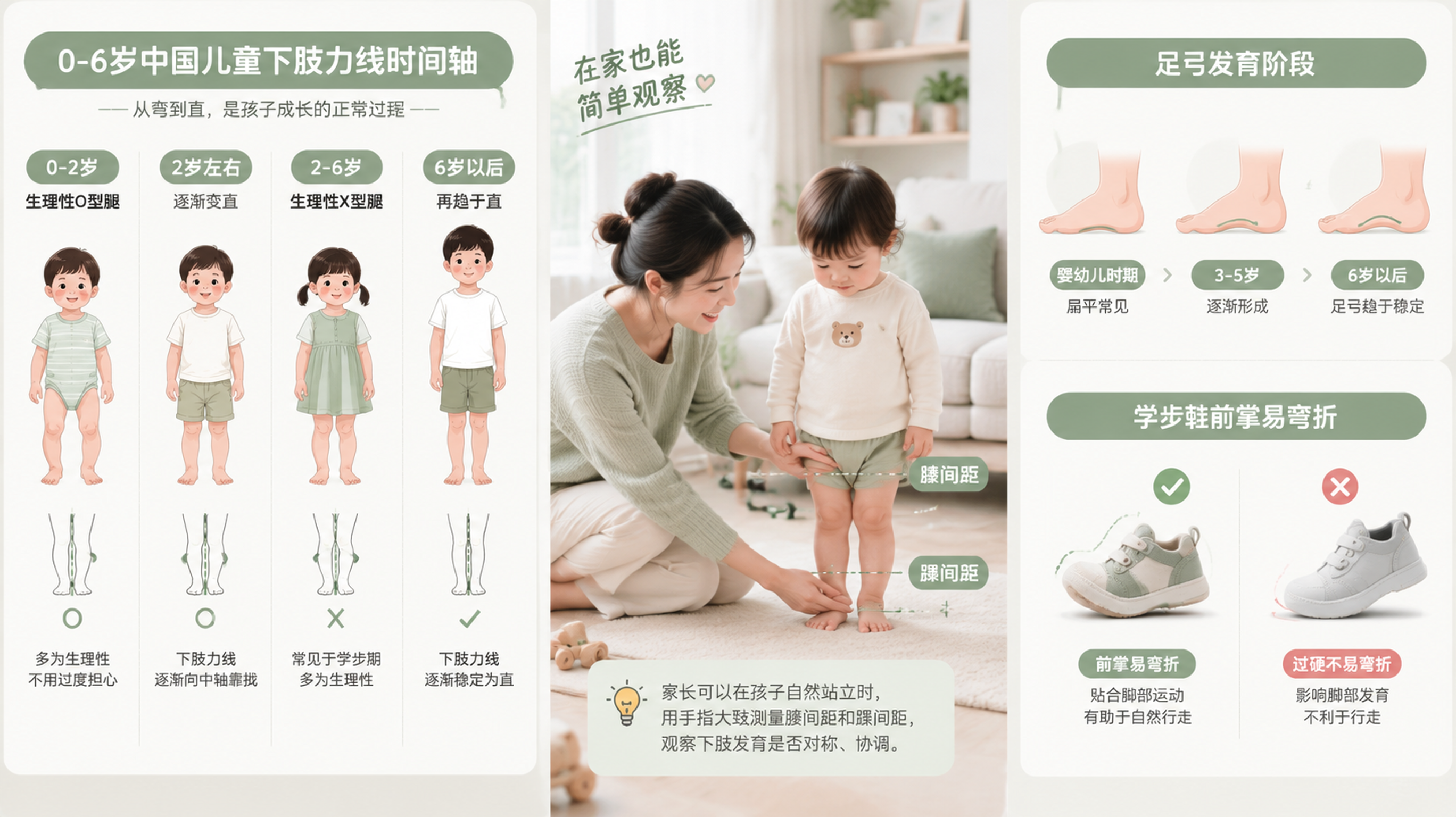 清爽临床科普插画风，画面分为三栏信息图：左侧为0-6岁中国儿童下肢力线时间轴（2岁前生理性O型腿、逐