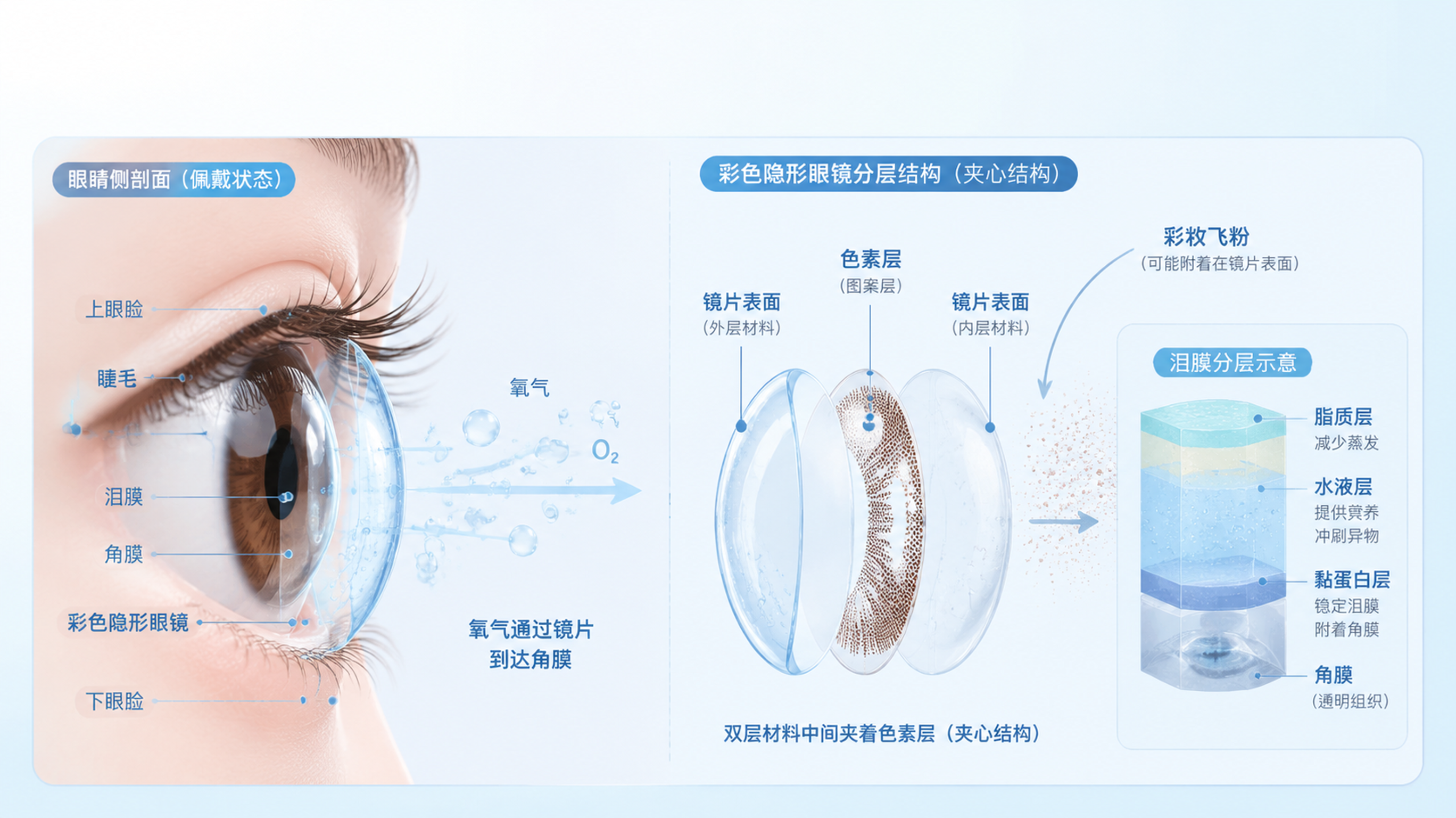 美瞳戴半天就干红？先查透氧和色素层