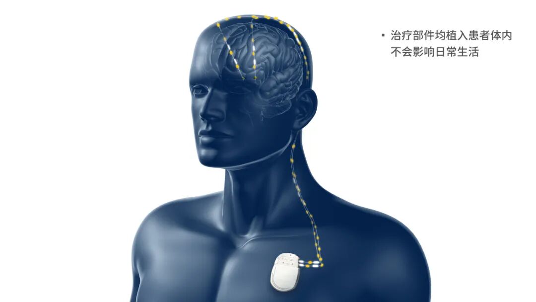 image-b87aaced.jpg