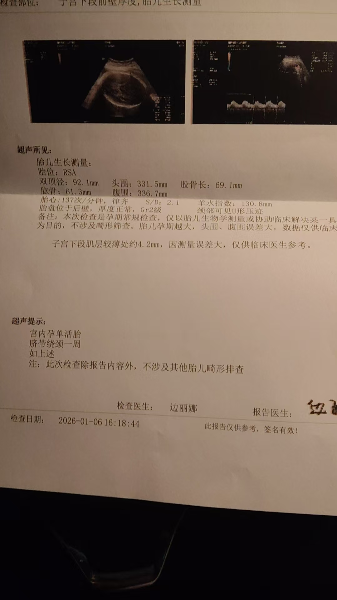 孕晚期体重控制与待产包准备