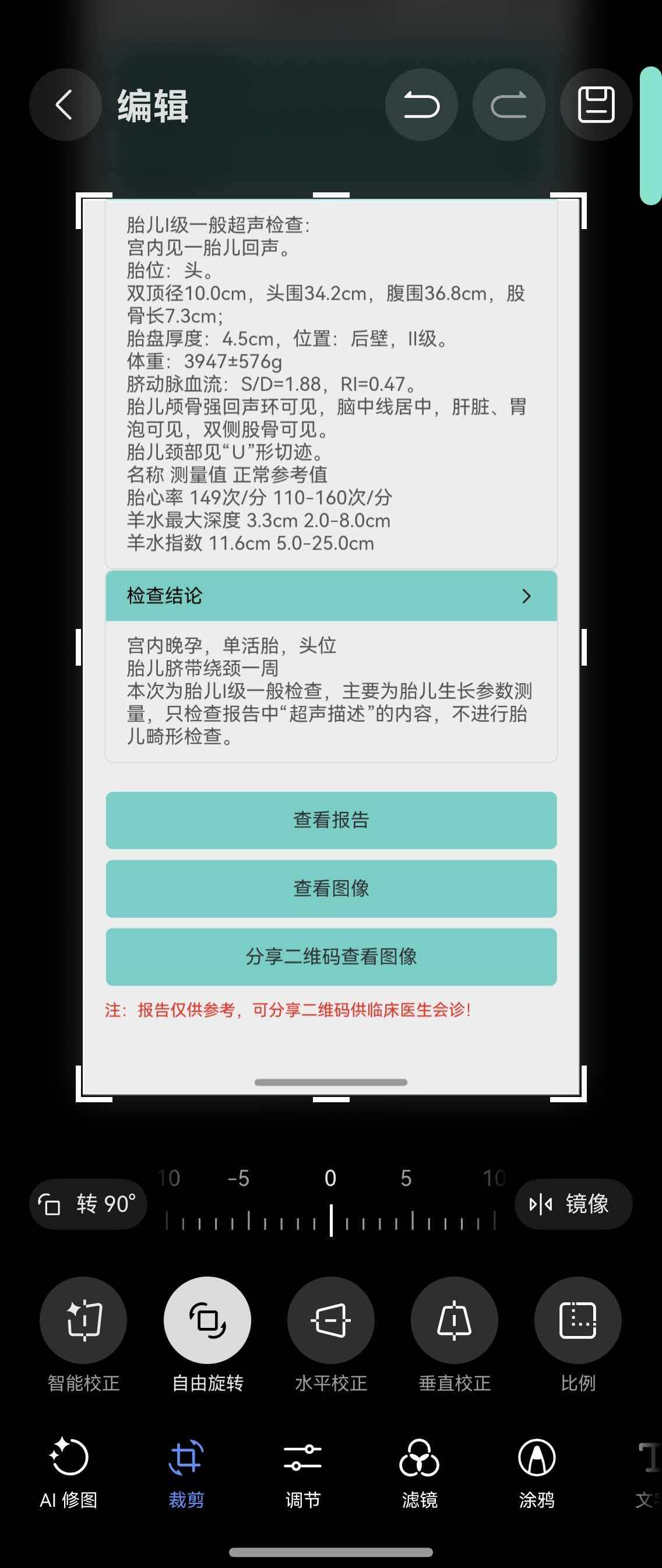 孕晚期催产记:当宝宝成了钉子户