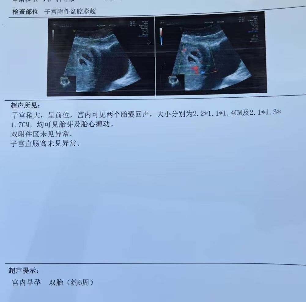 孕期迷信那些事儿