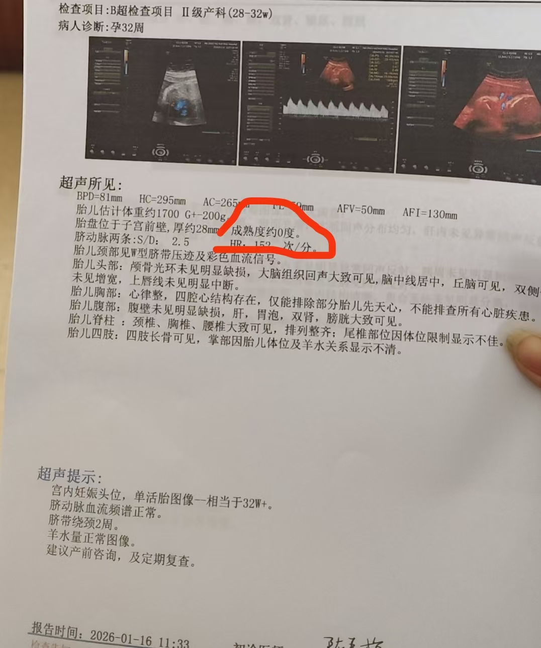 孕期焦虑与家庭矛盾