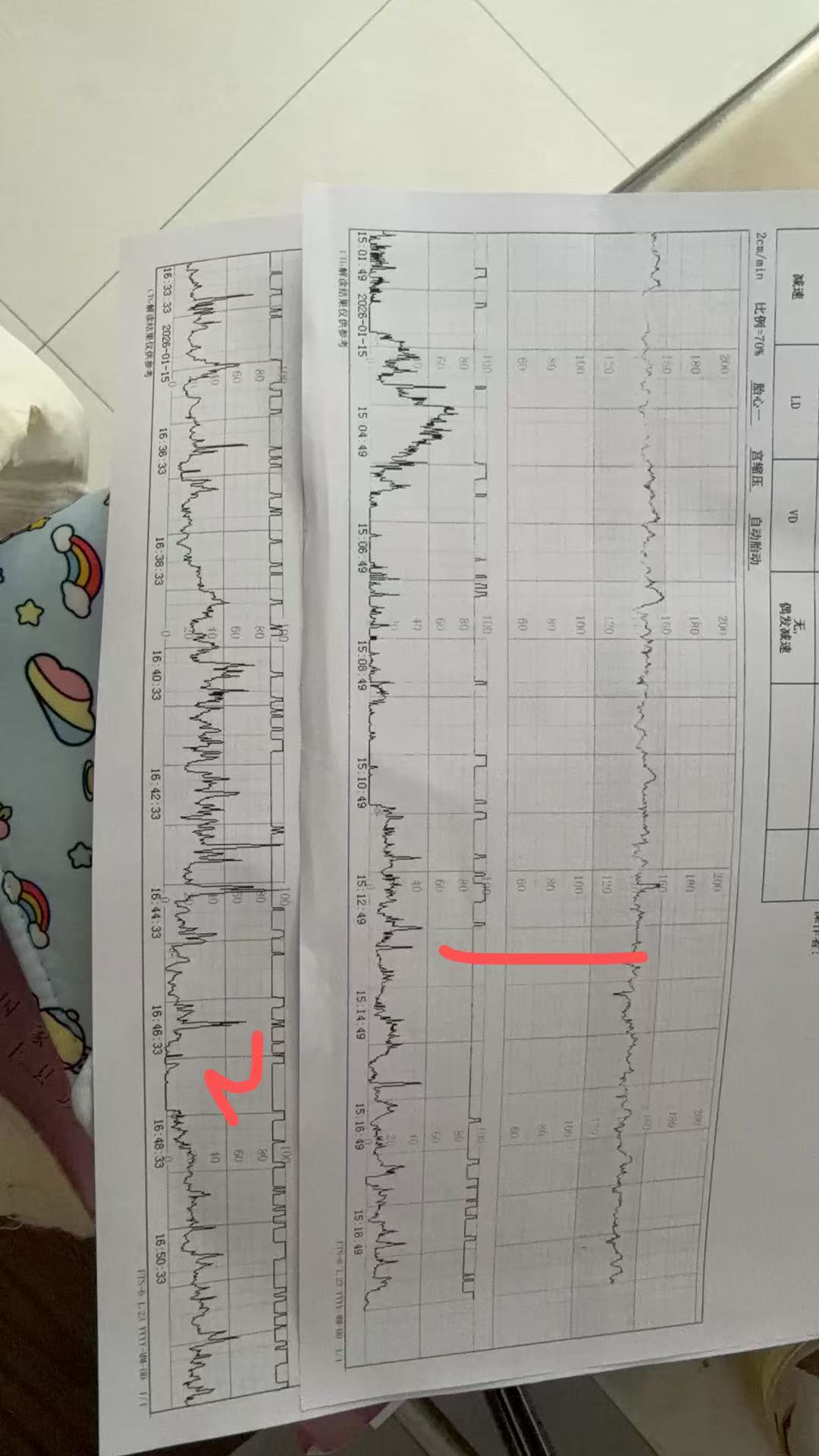 胎监不过关的焦虑与应对