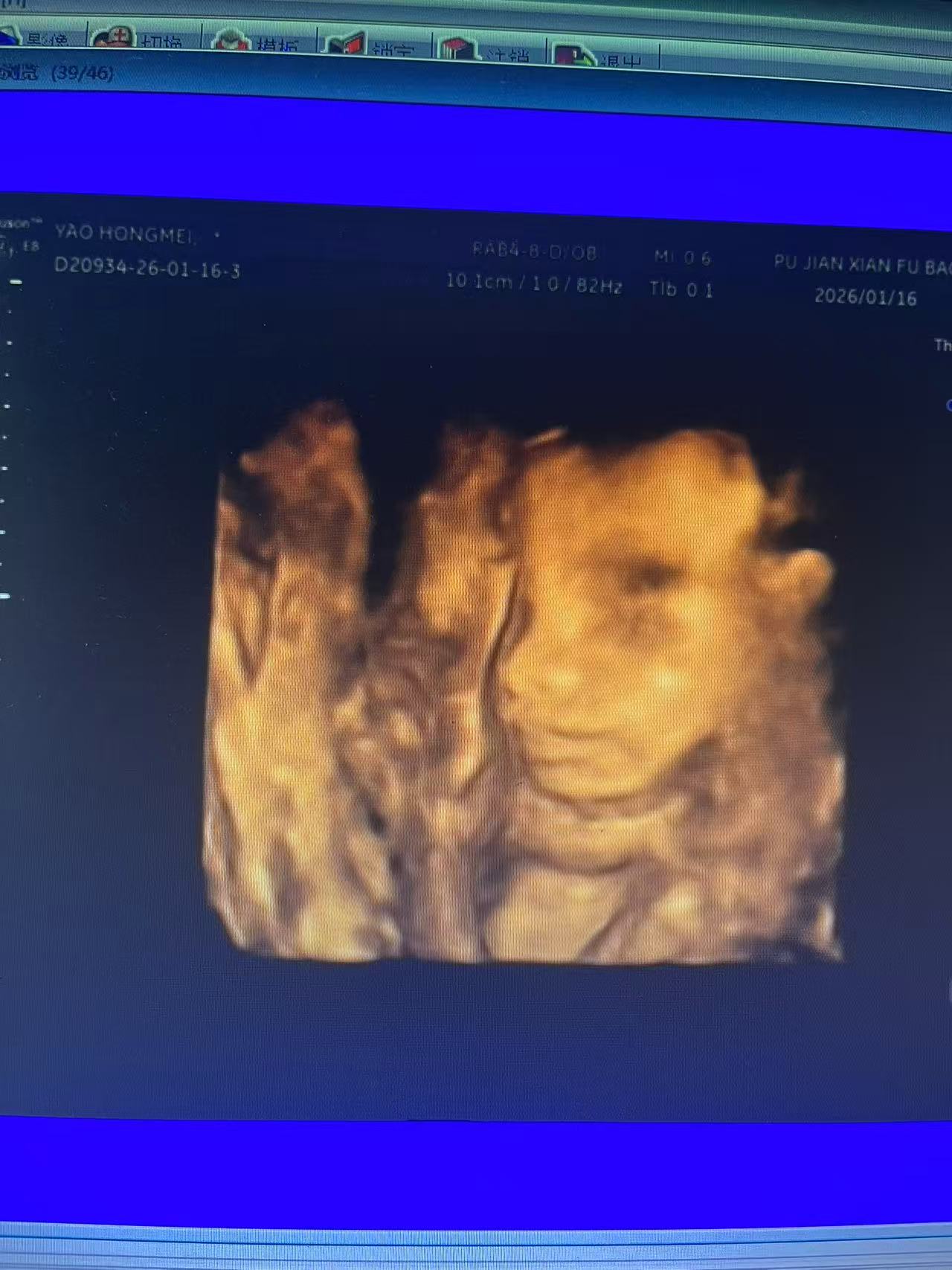 孕期产检那些事