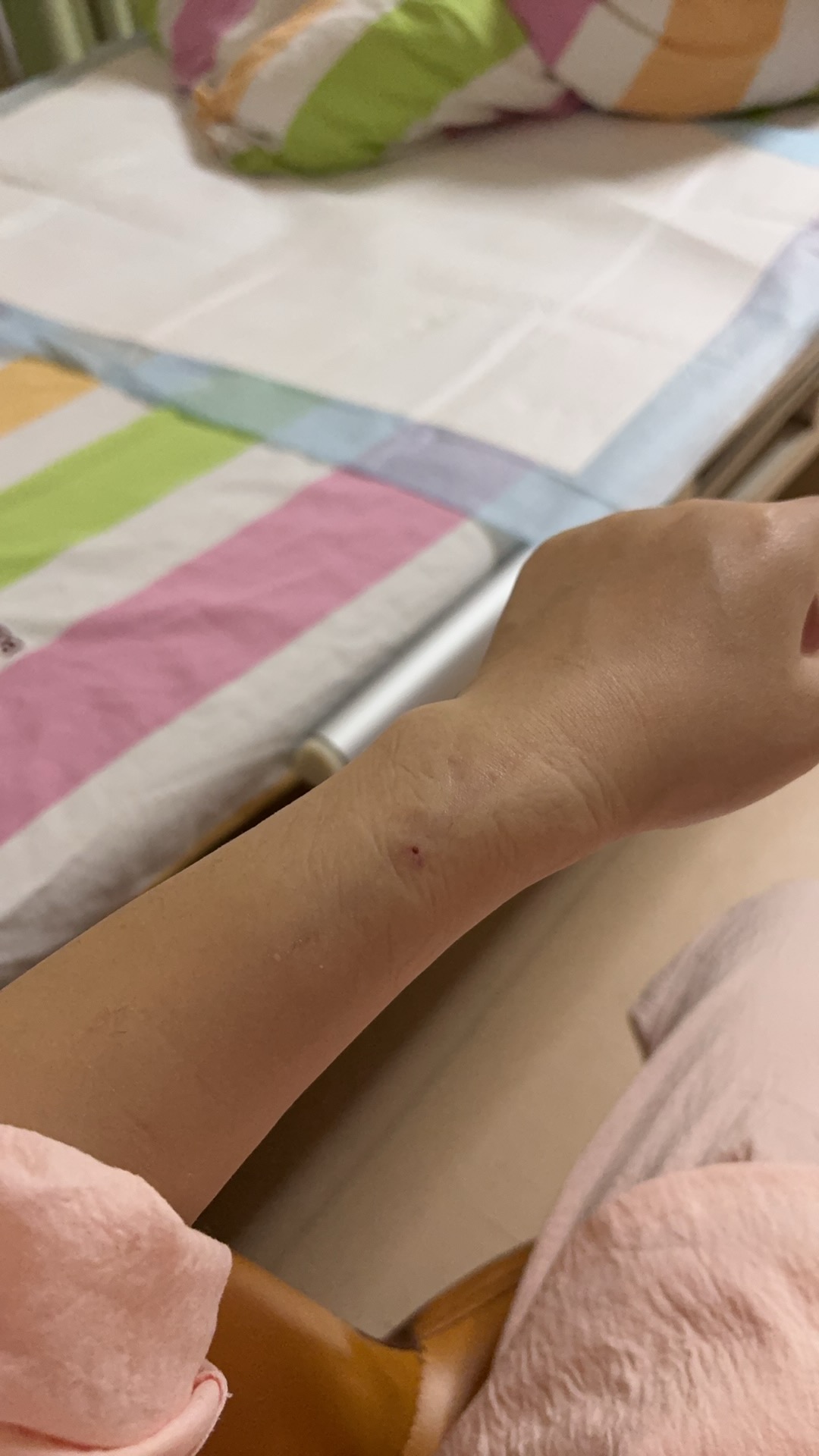 剖腹产后的恢复与护理