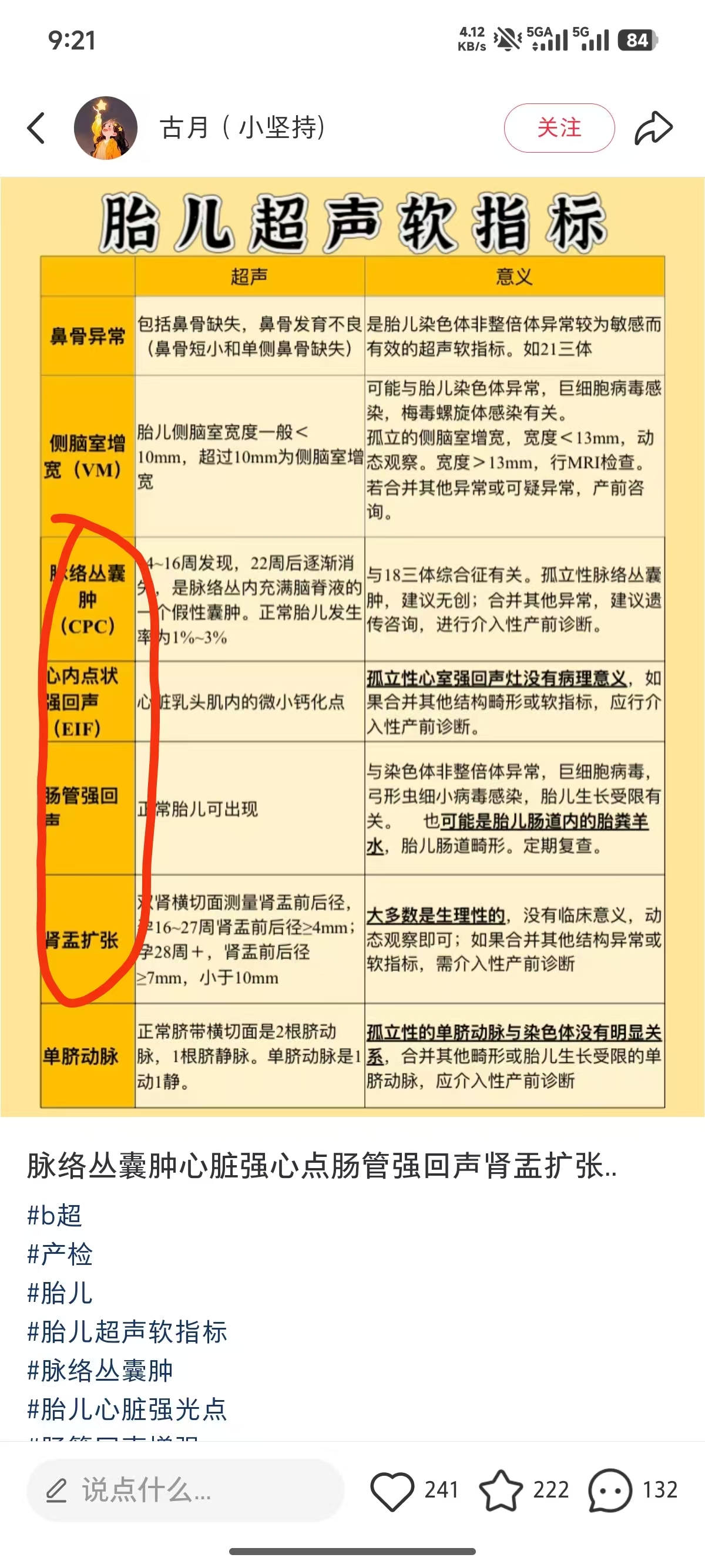 孕期B超检查的那些事儿