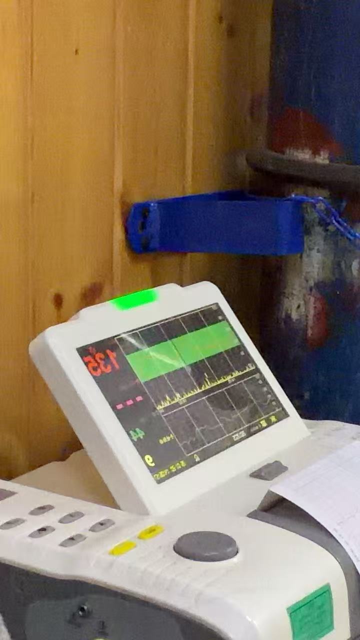 孕期B族链球菌检查经历