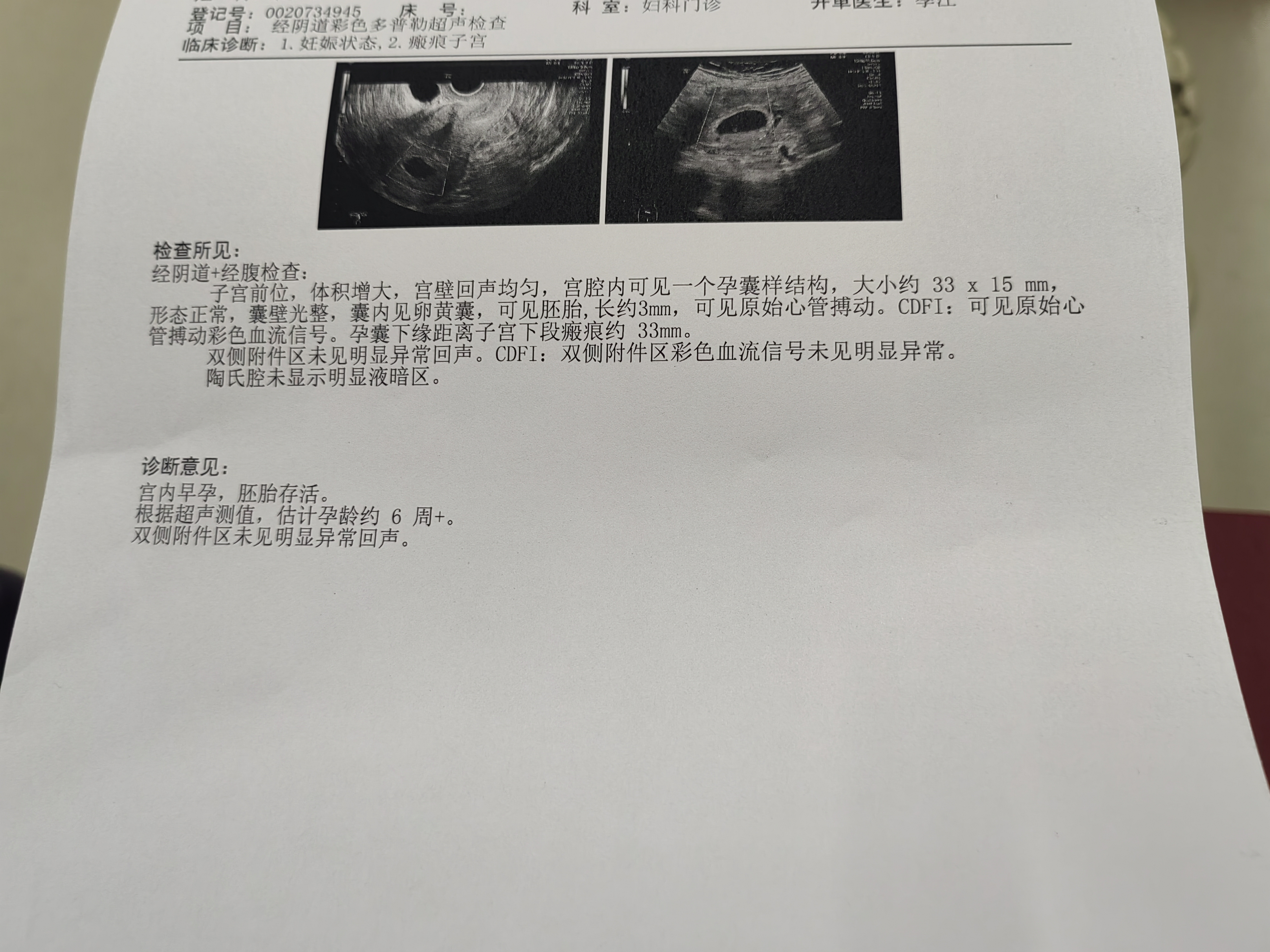 孕早期检查分享