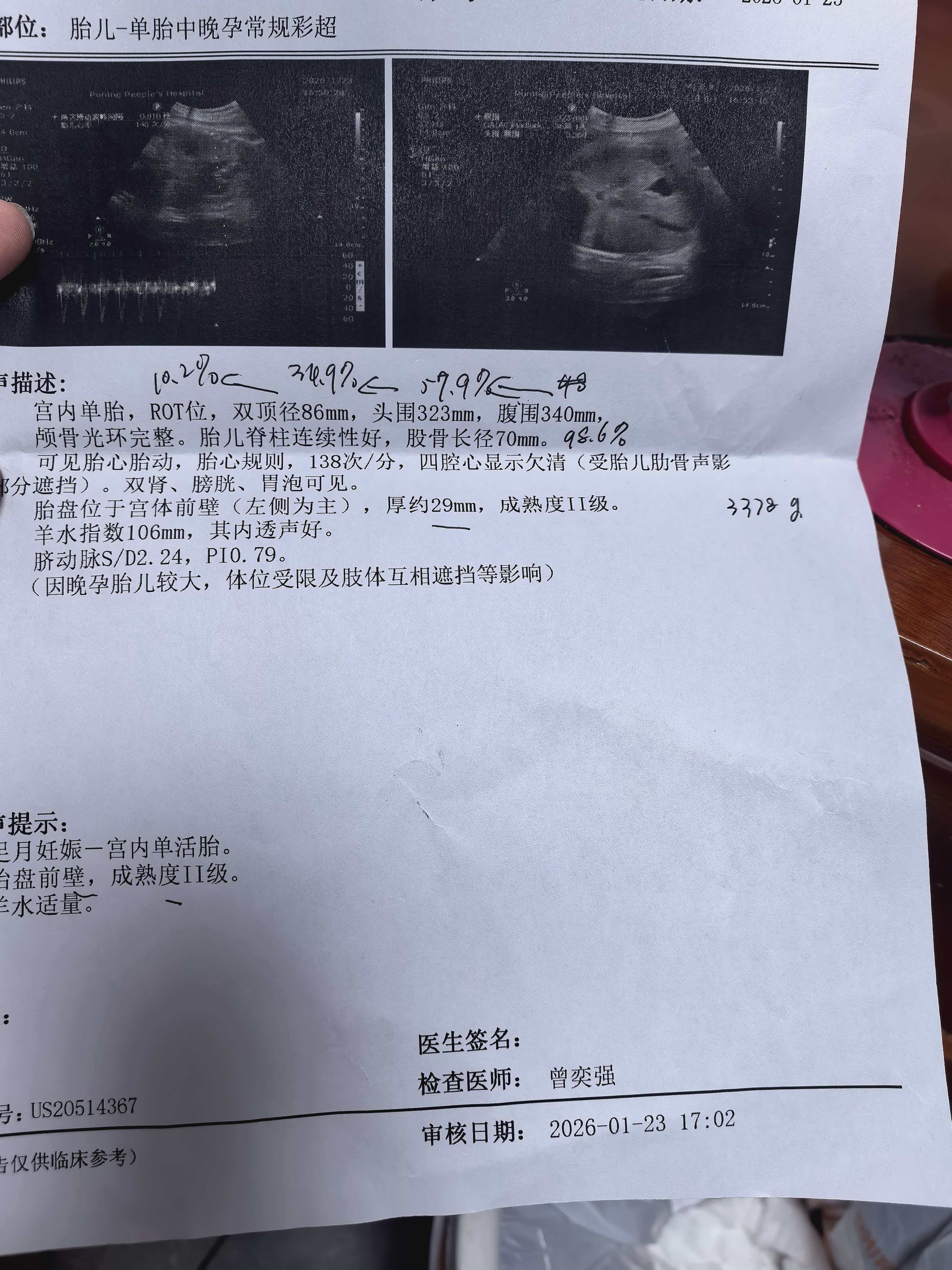 孕晚期的不适与期待